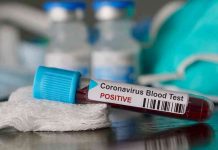 Confirman 19 casos con coronavirus en Antioquia