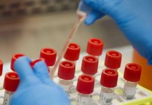 Segundo caso confirmado de coronavirus en El Santuario