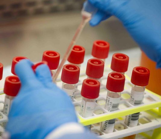 Segundo caso confirmado de coronavirus en El Santuario