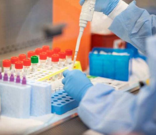 Universidad de Antioquia aisló virus que causa el Covid-19