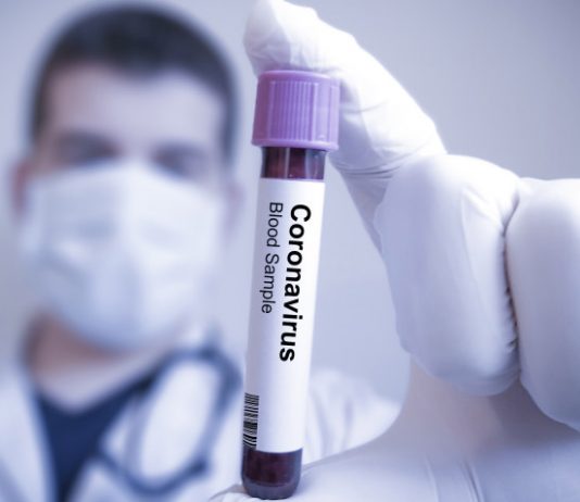 MinSalud confirmó segundo caso con Covid-19 en La Ceja