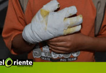 En El Retiro un menor de 13 años que había tomado licor se quemó con pólvora