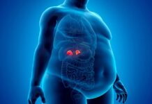 Síndrome de Cushing: la importancia de reconocer a tiempo una enfermedad poco común pero peligrosa