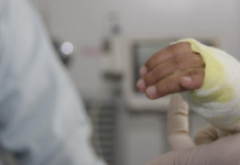 Granada reporta dos nuevos quemados por pólvora, uno de ellos menor de edad