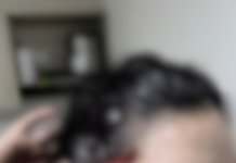 Maquilladora fue brutalmente agredida en Guatapé durante intento de robo en falsa cita laboral